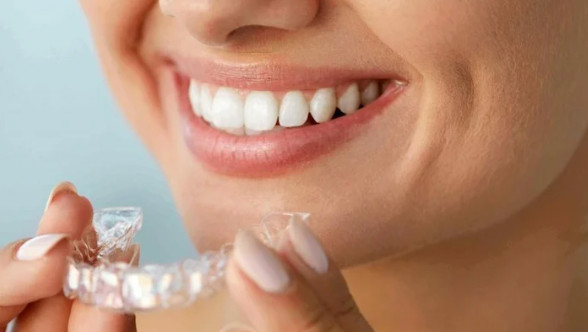 Mutuelle orthodontie adulte : ce qu’il faut savoir
